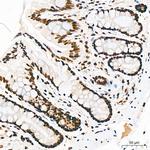 EFTUD2 Antibody in Immunohistochemistry (Paraffin) (IHC (P))