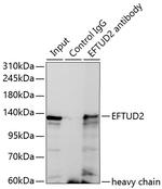 EFTUD2 Antibody in Immunoprecipitation (IP)