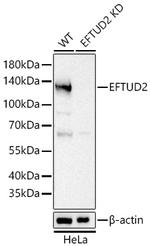 EFTUD2 Antibody in Western Blot (WB)