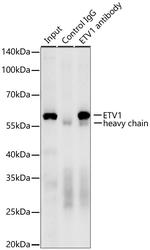 ETV1 Antibody in Immunoprecipitation (IP)