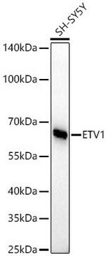 ETV1 Antibody in Western Blot (WB)