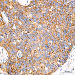 GRP94 Recombinant Rabbit Monoclonal Antibody (7P4V7)