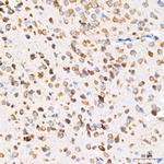 GRP94 Antibody in Immunohistochemistry (Paraffin) (IHC (P))
