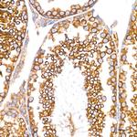 GRP94 Antibody in Immunohistochemistry (Paraffin) (IHC (P))