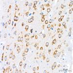 GRP94 Antibody in Immunohistochemistry (Paraffin) (IHC (P))