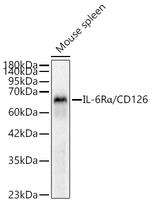 IL-6 Receptor Antibody in Western Blot (WB)