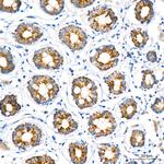 LRP130 Antibody in Immunohistochemistry (Paraffin) (IHC (P))