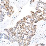 LRP130 Antibody in Immunohistochemistry (Paraffin) (IHC (P))