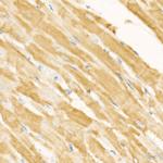 MARCH5 Antibody in Immunohistochemistry (Paraffin) (IHC (P))