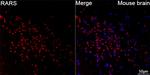 RARS Antibody in Immunohistochemistry (Paraffin) (IHC (P))