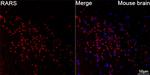 RARS Recombinant Rabbit Monoclonal Antibody (4Y1H4)