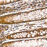 RARS Antibody in Immunohistochemistry (Paraffin) (IHC (P))