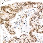 REPIN1 Antibody in Immunohistochemistry (Paraffin) (IHC (P))