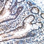 REPIN1 Antibody in Immunohistochemistry (Paraffin) (IHC (P))