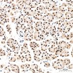 REPIN1 Antibody in Immunohistochemistry (Paraffin) (IHC (P))