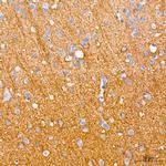 SCN3B Recombinant Rabbit Monoclonal Antibody (5X9J0)