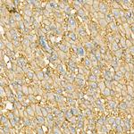 ZIP14 Antibody in Immunohistochemistry (Paraffin) (IHC (P))