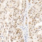 SOCS1 Recombinant Rabbit Monoclonal Antibody (6C6W1)