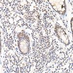 SOCS1 Antibody in Immunohistochemistry (Paraffin) (IHC (P))