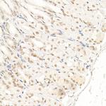 SOCS1 Antibody in Immunohistochemistry (Paraffin) (IHC (P))
