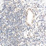 SOCS1 Antibody in Immunohistochemistry (Paraffin) (IHC (P))
