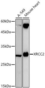XRCC2 Recombinant Rabbit Monoclonal Antibody (1T9D5)