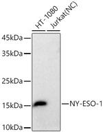 NY-ESO-1 Recombinant Rabbit Monoclonal Antibody (6U0N7)