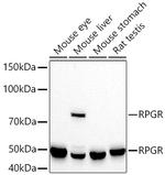 RPGR Recombinant Rabbit Monoclonal Antibody (0S8U8)