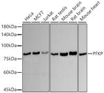 PFKP Recombinant Rabbit Monoclonal Antibody (8Y3S5)