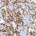 CD42b Recombinant Rabbit Monoclonal Antibody (6Y2I1)