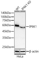 IP6K1 Antibody in Western Blot (WB)