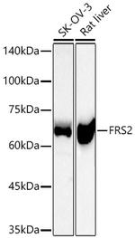 FRS2 Recombinant Rabbit Monoclonal Antibody (1K7X4)