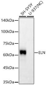 Elastin Recombinant Rabbit Monoclonal Antibody (9F5R1)