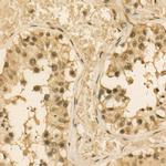 PSMC4 Antibody in Immunohistochemistry (Paraffin) (IHC (P))