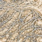 PSMC4 Antibody in Immunohistochemistry (Paraffin) (IHC (P))