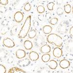 NGLY1 Recombinant Rabbit Monoclonal Antibody (9C10R7)