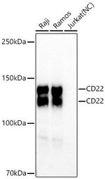 CD22 Recombinant Rabbit Monoclonal Antibody (3F2M10)