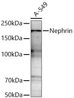 Nephrin Recombinant Rabbit Monoclonal Antibody (1S4U2)