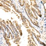GOLGA4 Antibody in Immunohistochemistry (Paraffin) (IHC (P))