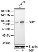 EGR1 Antibody in Western Blot (WB)