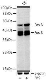 FosB Antibody in Western Blot (WB)
