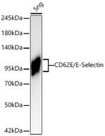 CD62E (E-Selectin) Recombinant Rabbit Monoclonal Antibody (9X1T0)