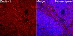 Dectin 1 Recombinant Rabbit Monoclonal Antibody (7L10N4)