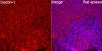 Dectin 1 Antibody in Immunohistochemistry (Paraffin) (IHC (P))