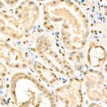RXRB Antibody in Immunohistochemistry (Paraffin) (IHC (P))