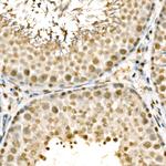 RXRB Antibody in Immunohistochemistry (Paraffin) (IHC (P))