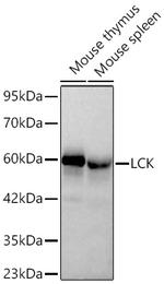 LCK Recombinant Rabbit Monoclonal Antibody (4C2L7)