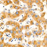 ASM Antibody in Immunohistochemistry (Paraffin) (IHC (P))