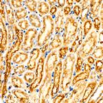 ASM Antibody in Immunohistochemistry (Paraffin) (IHC (P))