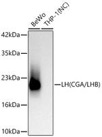 CGA Recombinant Rabbit Monoclonal Antibody (0I8N3)